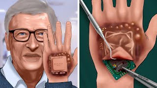 ASMR Help Bill Gates get the Microsoft chip out of his hands | Relax Animation | NEW YEAR video