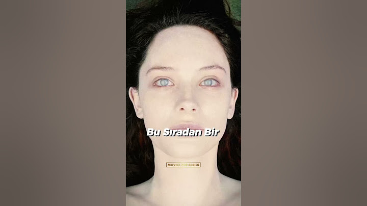 Bu Kadının Başına Ne Geldi?🤯