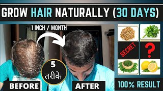 5 Things To Grow Hair Naturally In 30 Days | Grow Your Hair Faster & Longer | Grow Long Hair Fast