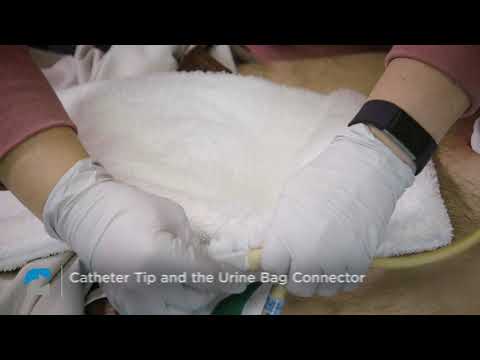 Video: Een foley-katheter irrigeren (met afbeeldingen)
