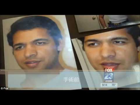 失败的整容