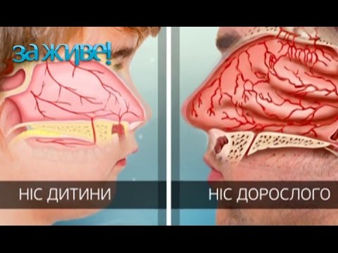 5 ошибок, которые вы допускаете при кровотечении из носа – За живе! Сезон 4. Выпуск 30 от 18.04.17