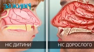 5 ошибок, которые вы допускаете при кровотечении из носа – За живе! Сезон 4. Выпуск 30 от 18.04.17