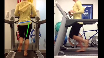 Video Gait Analysis