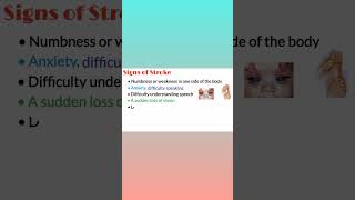 Signs of Stroke, Signs and Symptoms of Stroke, Youtube Shorts, Medical Shorts