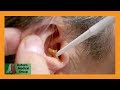 Dr. Gawayne Cleans Ears After Bell's Palsy | Auburn Medical Group