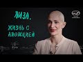 Лиза. Жизнь с алопецией. Интервью для вМесте