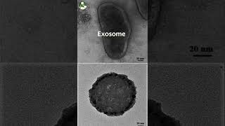 Your Body sets Traps for Infections like Virus and Bacteria. Exosomes | Life M.D. #shorts