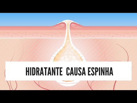 Vídeo: A manteiga de karité causa acne?