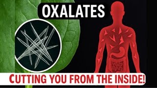 Oxalates: The Tiny Shards of Glass Hiding in Your Food #oxalates #kidneystones