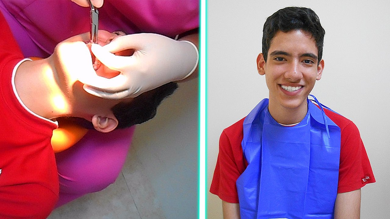 ninja air fryer ASI FUE COMO ME QUITARON LOS BRACKETS | TheDonato Vlog #2