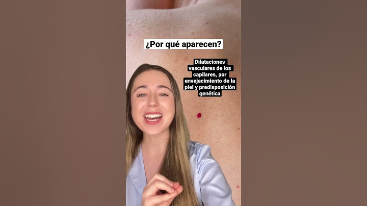 Cómo eliminar LUNARES ROJOS ❤️ #dermatologia #skincare #pielperfecta #lunares #shorts