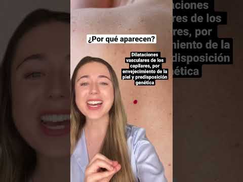 Vídeo: Pots eliminar el relleu de la pell?