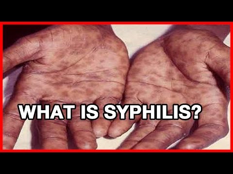 What is Syphilis? @HealthWebVideos