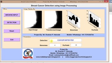 Matlab code for Breast Cancer Detection using image processing