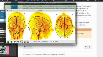 Nilearn: Machine learning for Neuro-Imaging in Python