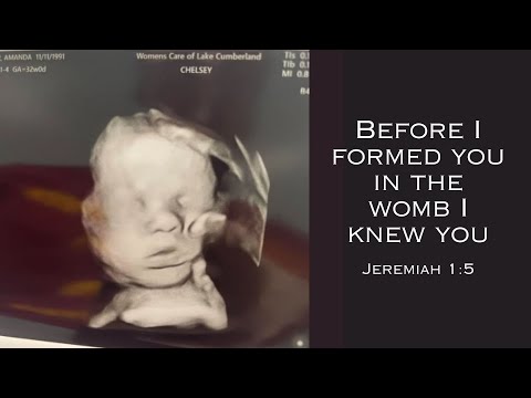 صورة الأشعة الصوتية لأماندا فوستر ت ظهر يد الله تلمس طفلها