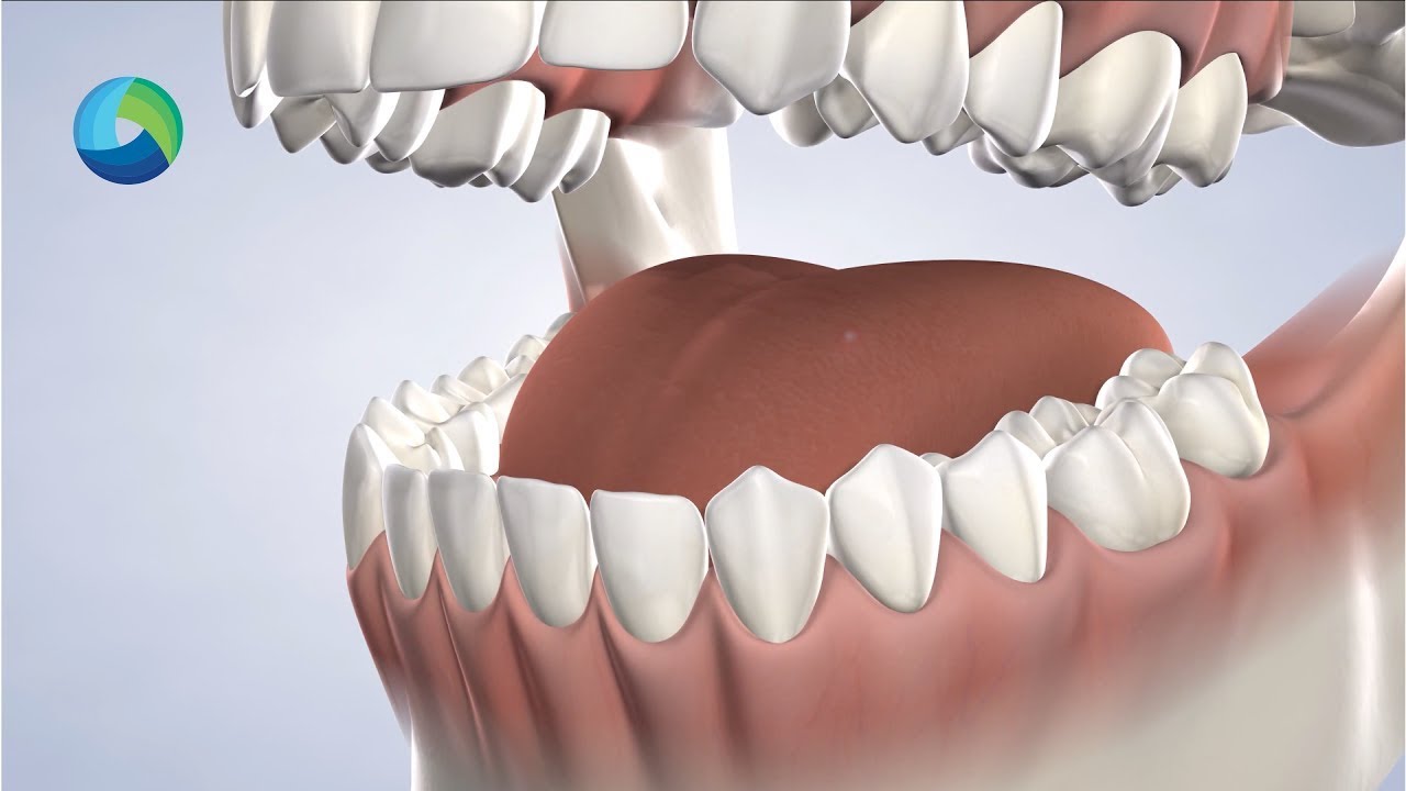 Oral Pathology in New Brunswick, NJ at Oral Surgery Group YouTube