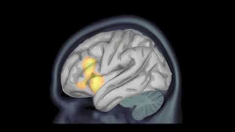 60 seconds in the life of brain