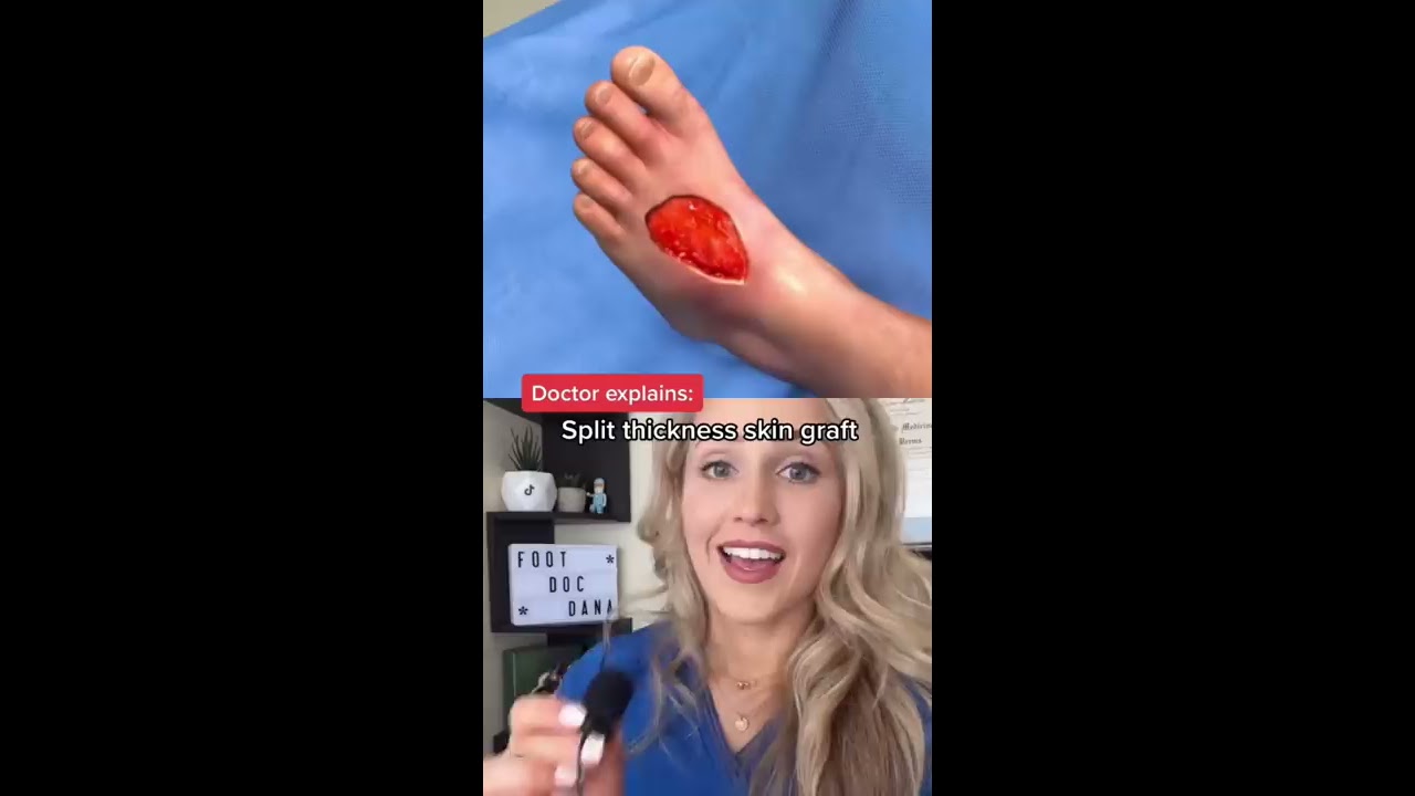  Doctor Reacts Foot Transplant Surgery