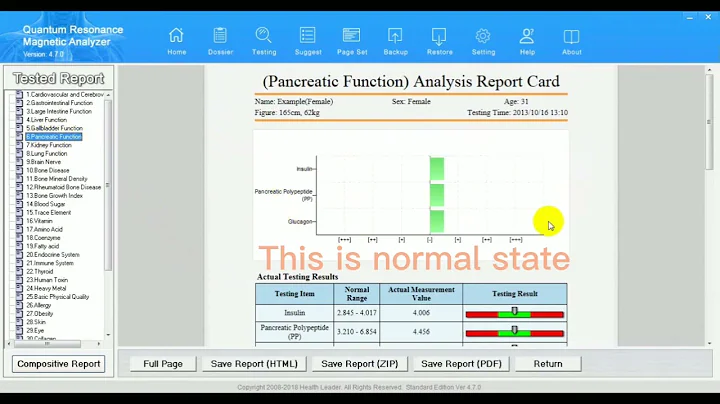 How to make quantum report column display or not display