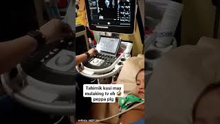 2D echo #aiden #mycancerjourney #wilmstumor