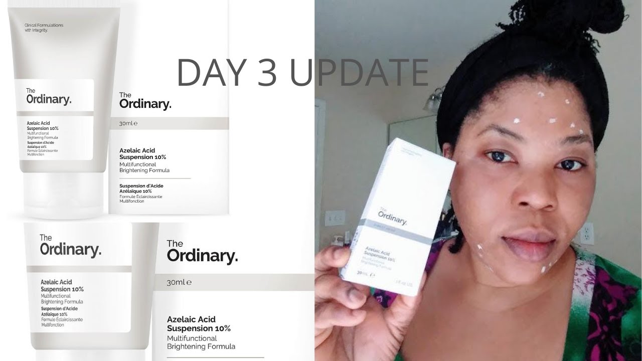 Dark Circle HYPERPIGMENTATION around D EYES] Using Azelaic Acid