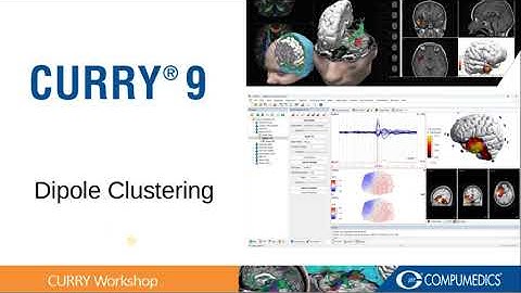 CURRY 9 - Automatic Spike Detection and Dipole Clustering