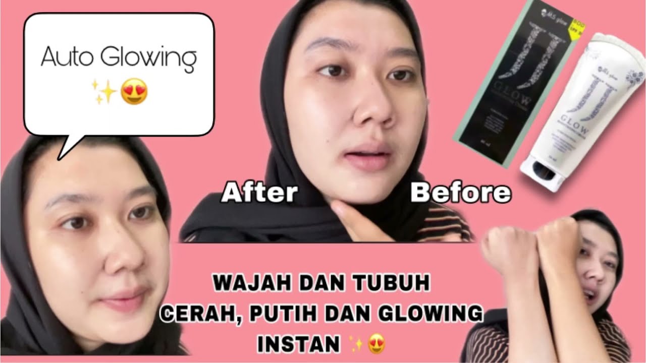 REVIEW JJ GLOW BY MS GLOW | TIPS WAJAH DAN TUBUH CERAH LEBIH CEPAT | ANTI KUSAM, BELANG, DAN FLEK 😍