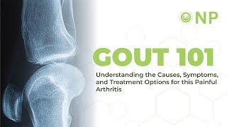 Gout 101: Understanding the Causes, Symptoms, and Treatment Options for this Painful Arthritis