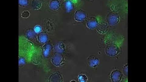 Neutrophil Extracellular Traps (NETs) Visualization