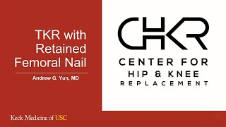 Total Knee Replacement With Retained Femoral Nail