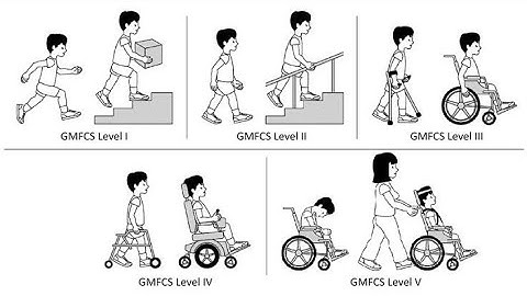 Gross Motor function Classification System   GMFCS; five level tool for cerebral Palsy