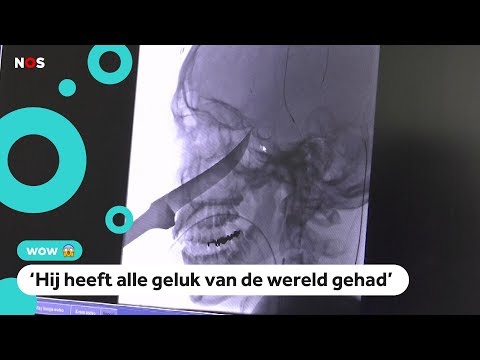 Video: Wat is een gebroken kogel?