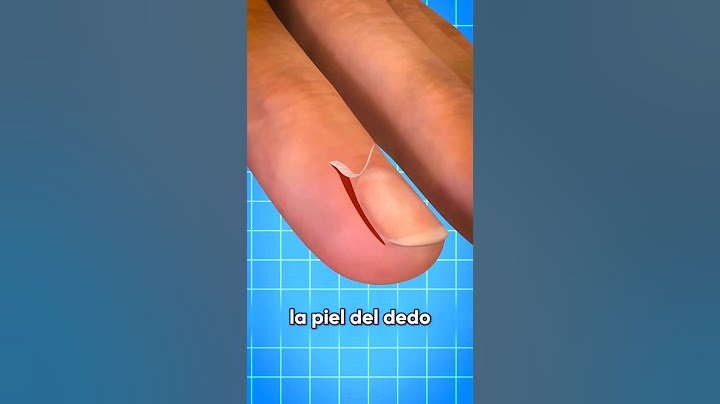 Nunca te saques la PIEL del dedo de esta manera😱