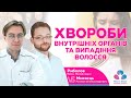 (checkmark) Хвороби внутрішніх органів та випадіння волосся