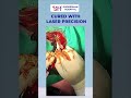 Our First Step in Advanced Care | First Surgery at Sudershan Hospital | Dr Pradeep Kumar Neerunemula