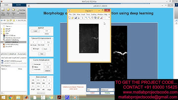 Deep learning segmentation of optical microscopy images improves 3D neuron reconstruction