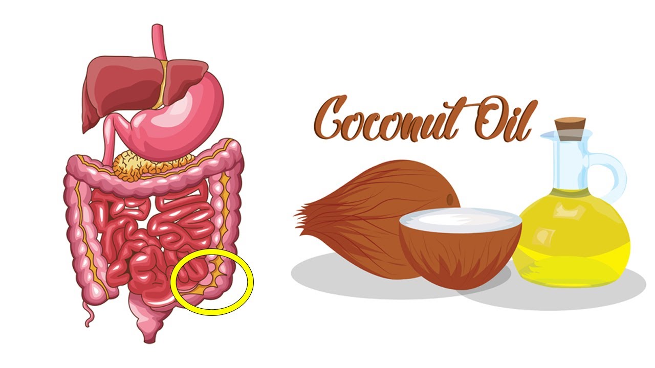 Coconut Oil Kills 93 of Colon Cancer Cells According to New Study