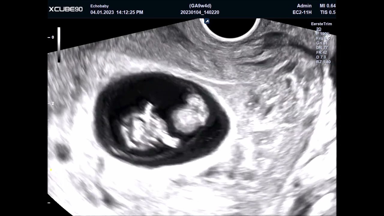 Echo 9 Weken, Filmpjes