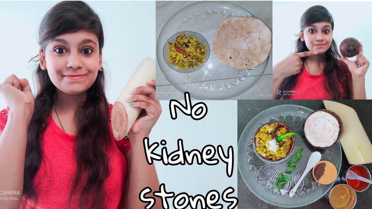The Natural Home Remedy for Kidney Stones।Banana Stem Recipes Part 2