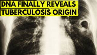 Details DNA Finally Reveals Where Tuberculosis REALLY Came From Guide