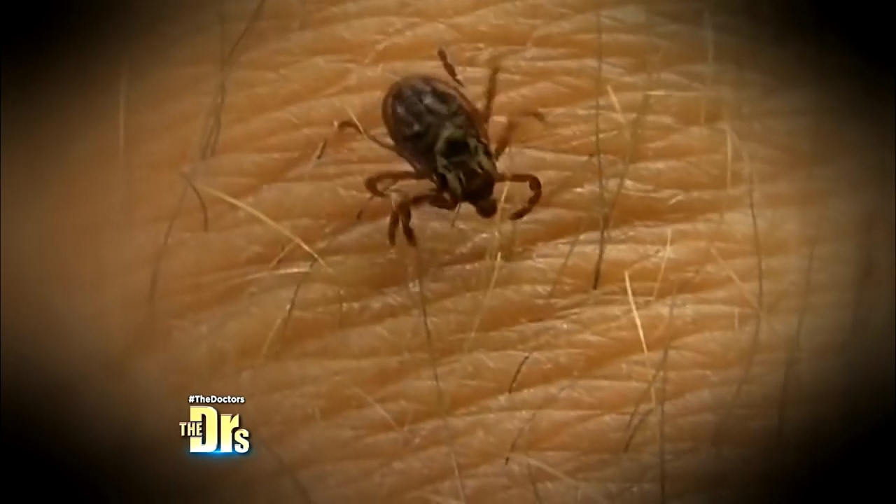Tick Paralysis YouTube