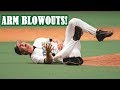 MLB | ARM BLOWOUTS! (TERRIBLE ARM INJURIES) | 1080p HD