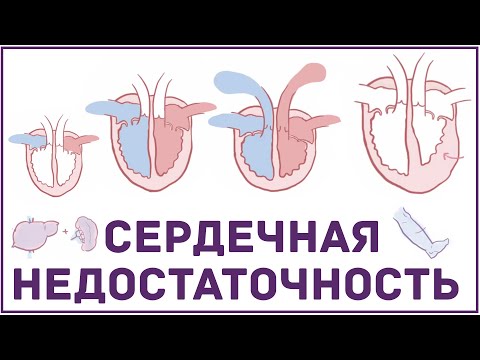 Видео: Острая сердечная недостаточность: типы, причины и симптомы