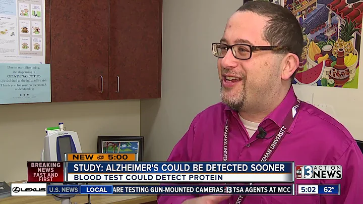 New study says Alzheimer's could be detected sooner