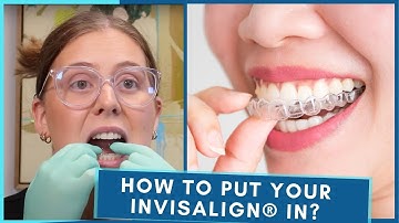 How To Put Your Invisalign® In | Step by Step Guide