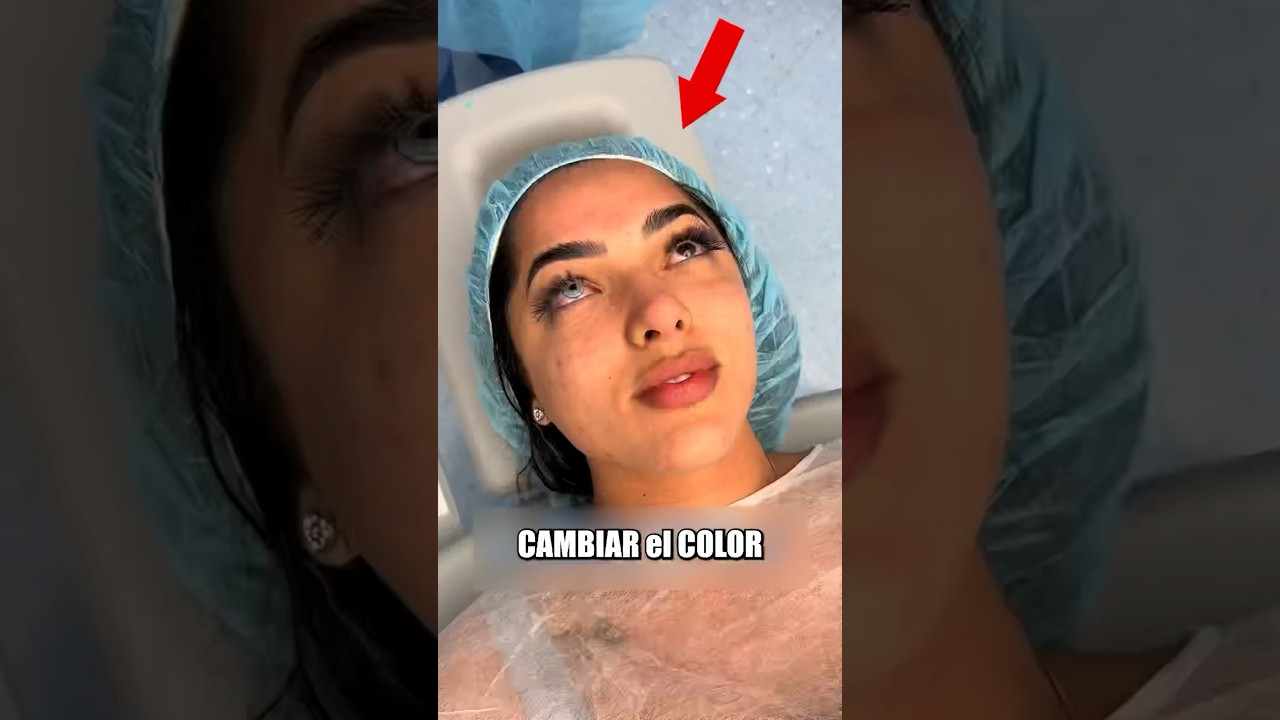 CLÍNICA hace CAMBIO de COLOR de OJOS 😨