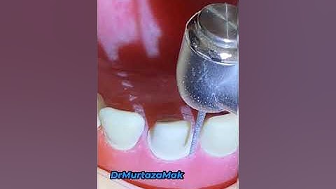 Samurai Dental Skills- Crown prep skills