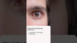 What should I do if I get a chemical in my eye? | Apollo Hospitals